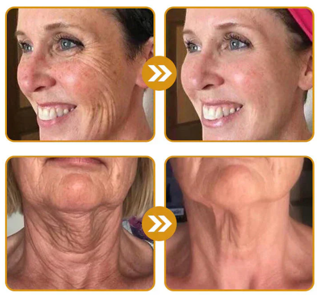 Bee Venom™ Skin Cream