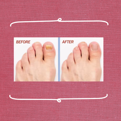 NailClear™ - Clear nails. Confident steps.
